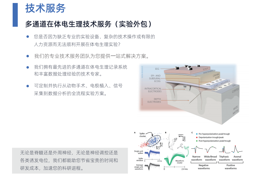 spike sorting 程序占位图